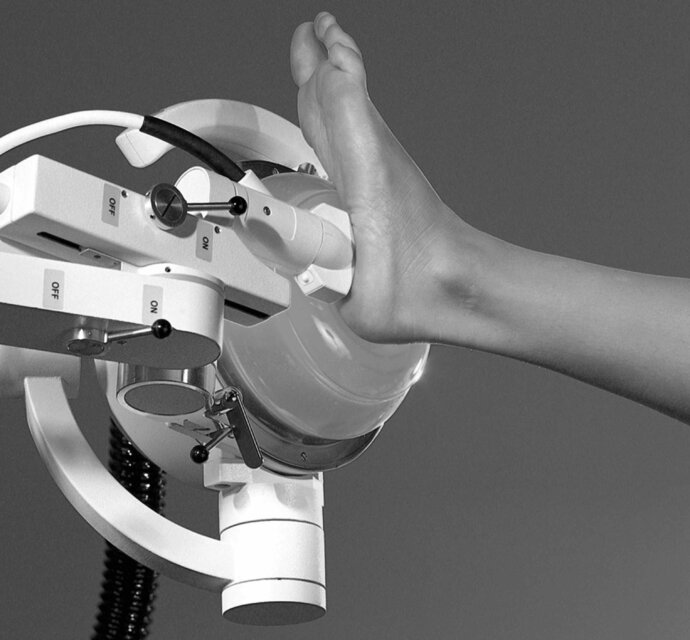 Epos shock wave therapy foot bw